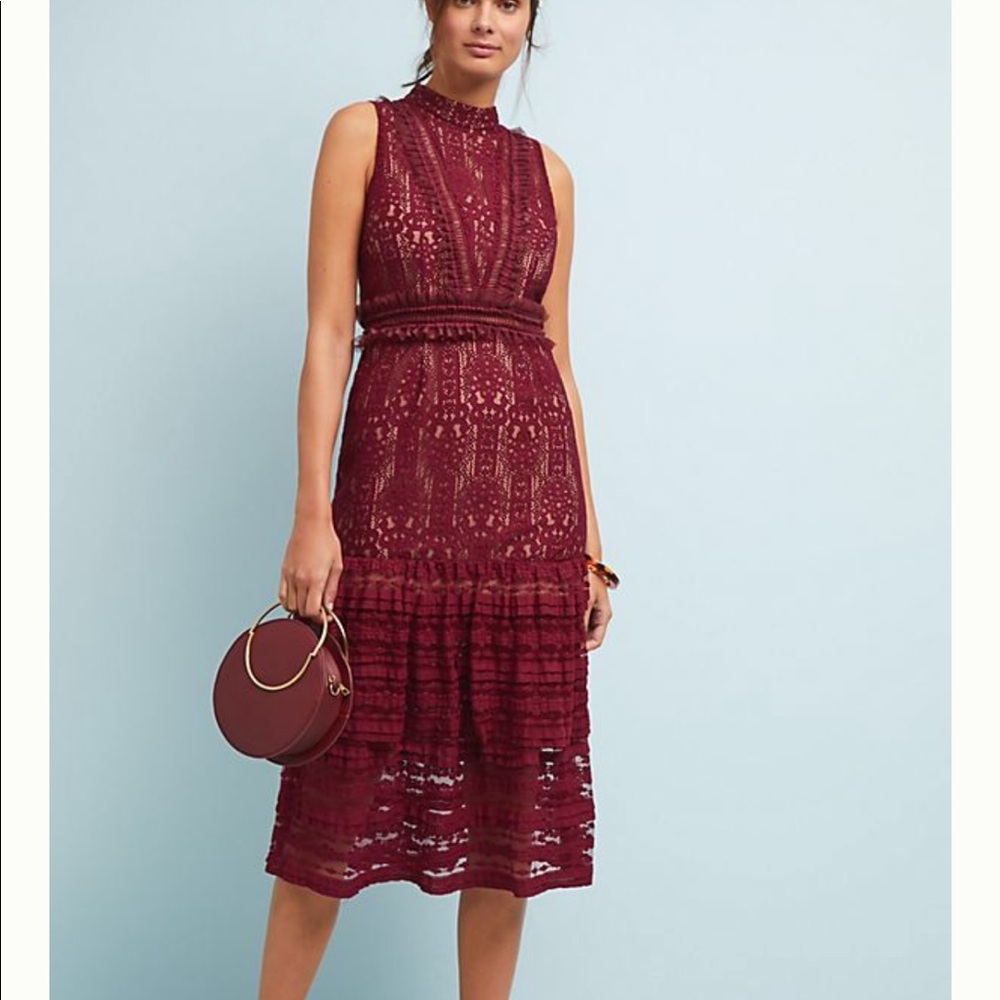 Anthropologie Endless Rose Lindsey Lace Dress